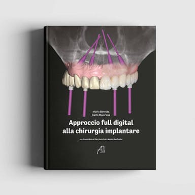 Immagine copertina Approccio full digital alla chirurgia implantare