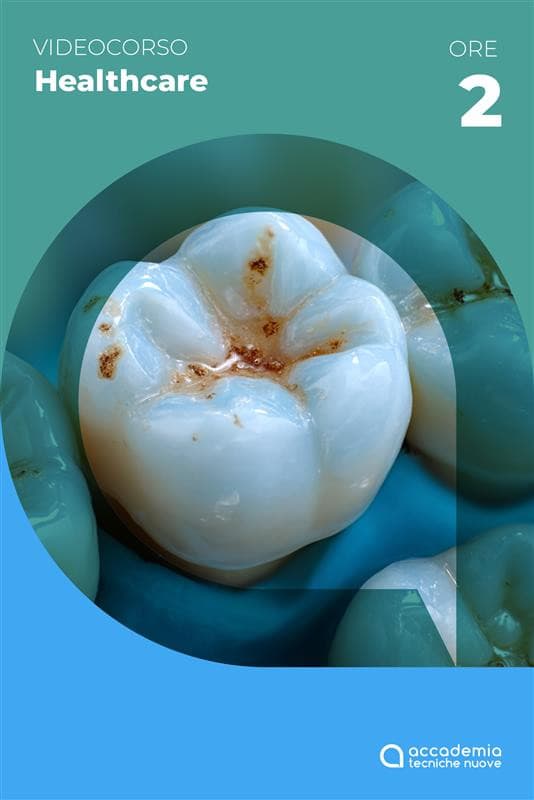 La gestione diagnostica-clinica dei solchi e delle fossette occlusali pigmentate - 2023